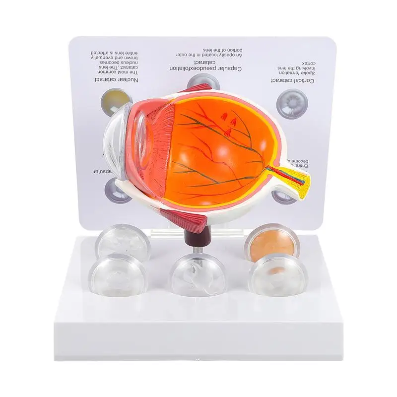 Демонстрационный набор для демонстрации болезни глаз от роговицы | Канцтовары