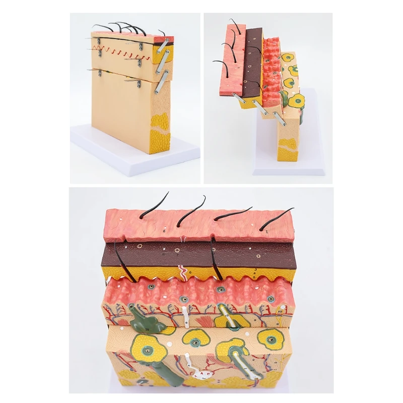 

Realistic Skin Model 70X Enlarged Anatomical Model Anatomy for Science Classroom Study Display Teaching Model