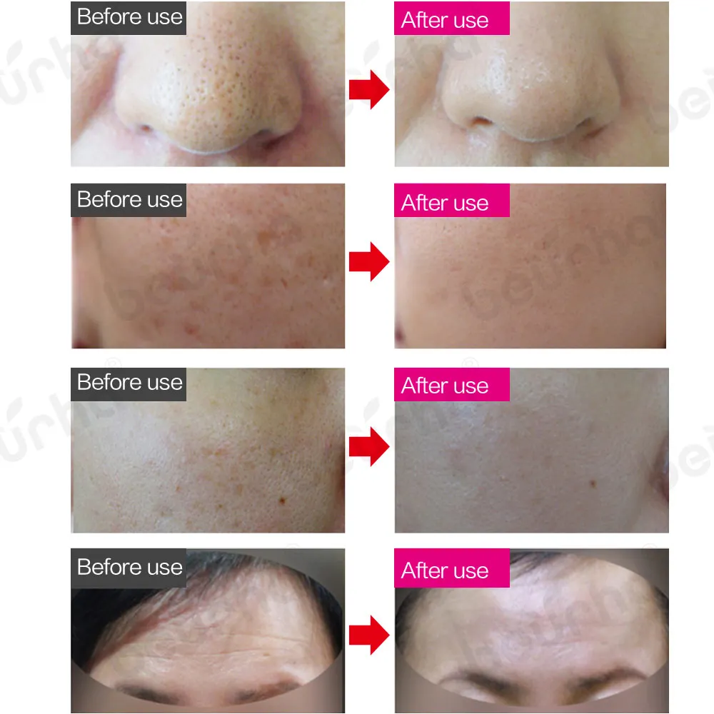 Маска светильник отбеливающая для лица светодиодный цветов|Светодиодная маска