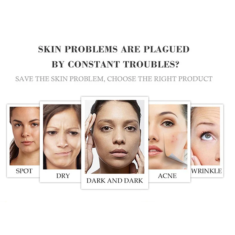 

Effective Whitening Freckle Cream Remove Melasma Acne Spot Pigment