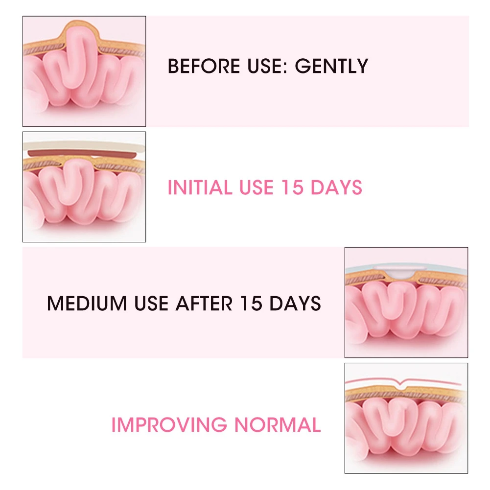 2 шт. дышащие эластичные ремешки для волос|Брекеты и подставки| |