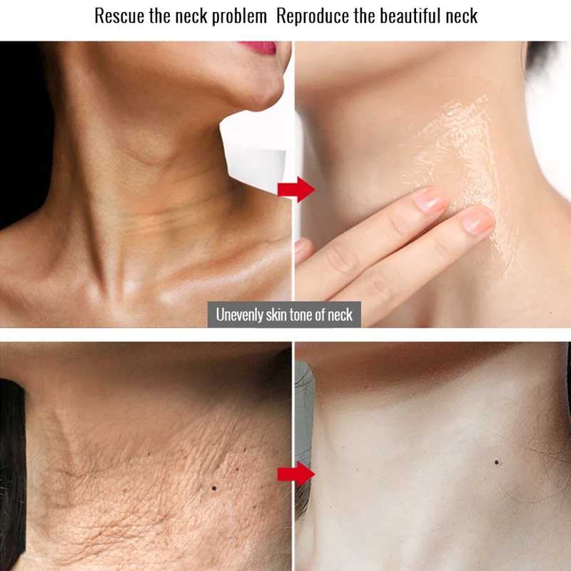 5 шт. отбеливающий питательный крем для области шеи|Шея| |