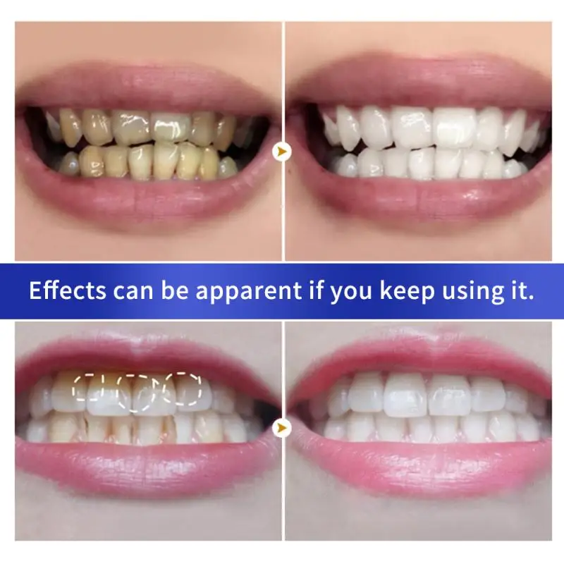 Жемчуг и пасты отбеливание зубов порошок Профессиональный эффективная зубная