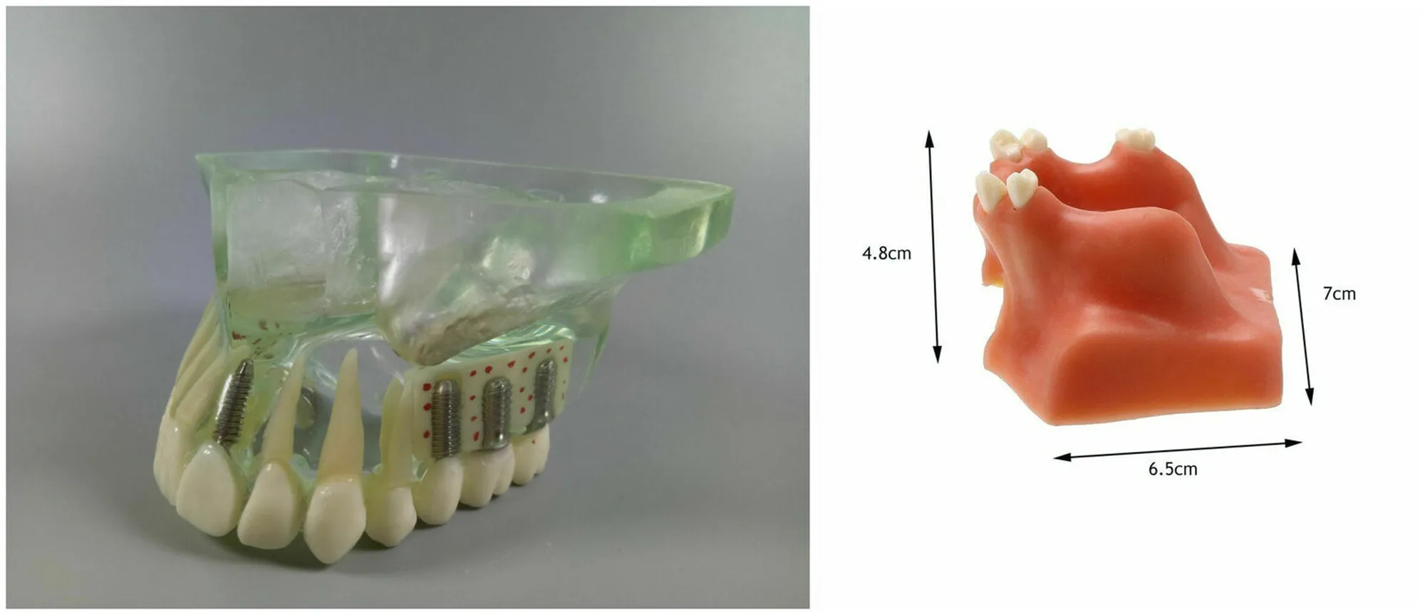 

Dental Teaching Model NISSIN Kilgore Implant Upper Jaw Sinus Lift Crown Bridge