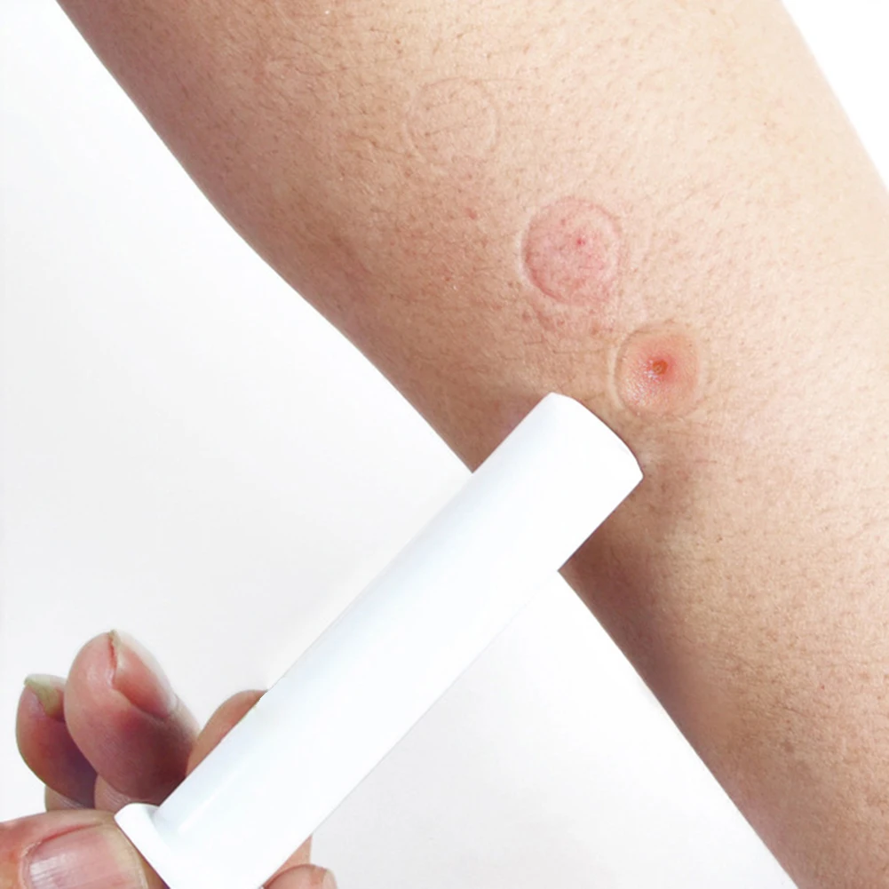 Для безопасности кемпинга всасывающий насос на открытом воздухе яда змея укуса