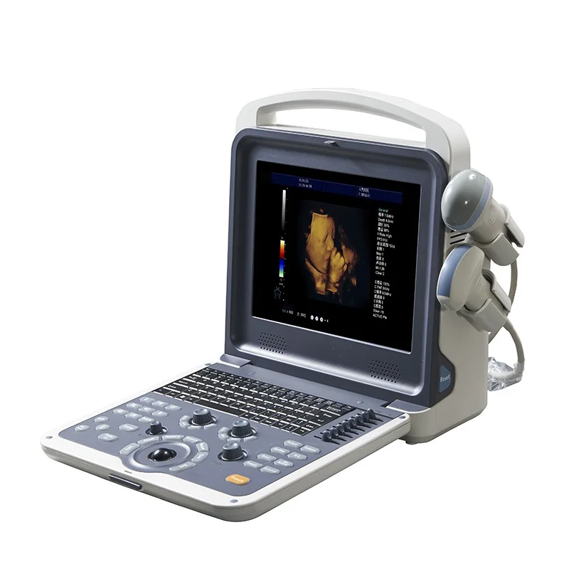 PC ultrasound scanner medical color doppler  ultrasound instruments