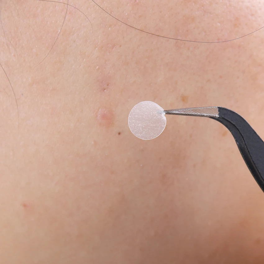 36 шт. невидимые пластыри от прыщей и акне |