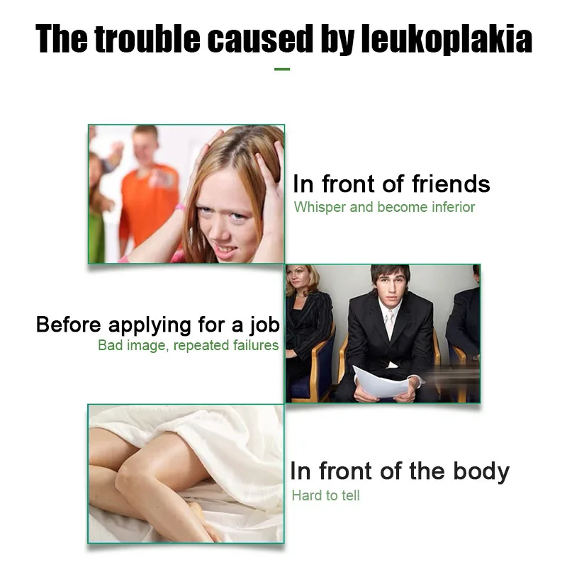White Spot Vitiligo Treament Cream Leukoplakia Disease Repair Antibacterial Ointment Medical Plaster Skin Care | Красота и здоровье