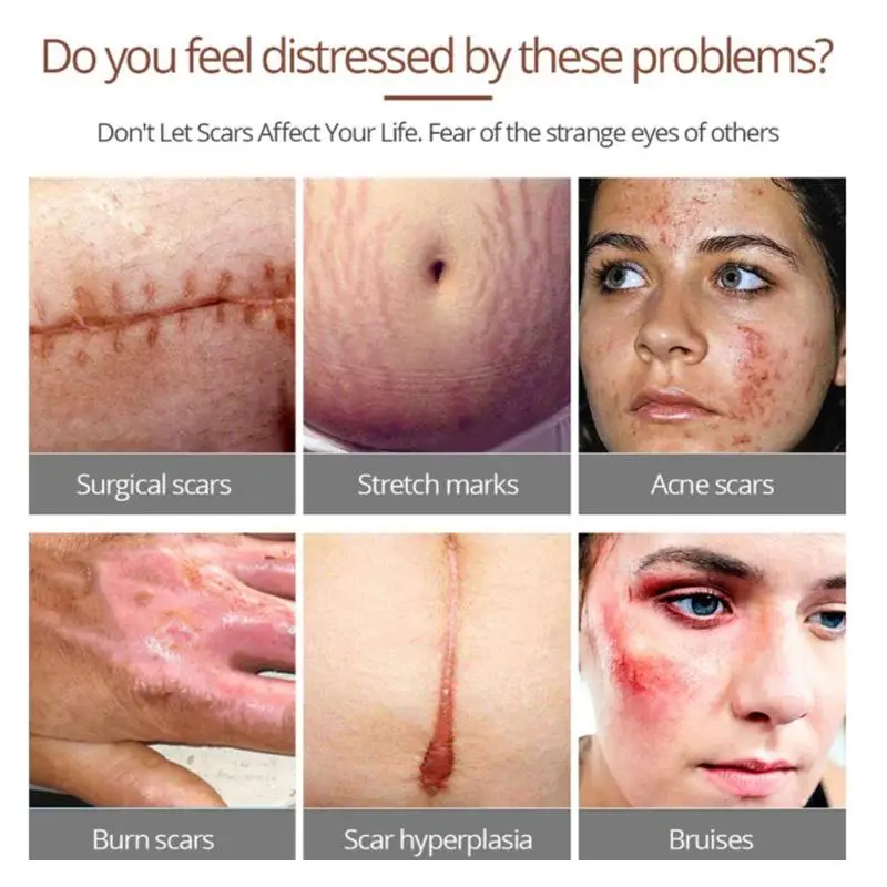 Средство для ухода за кожей под крокодила|Сыворотка| |