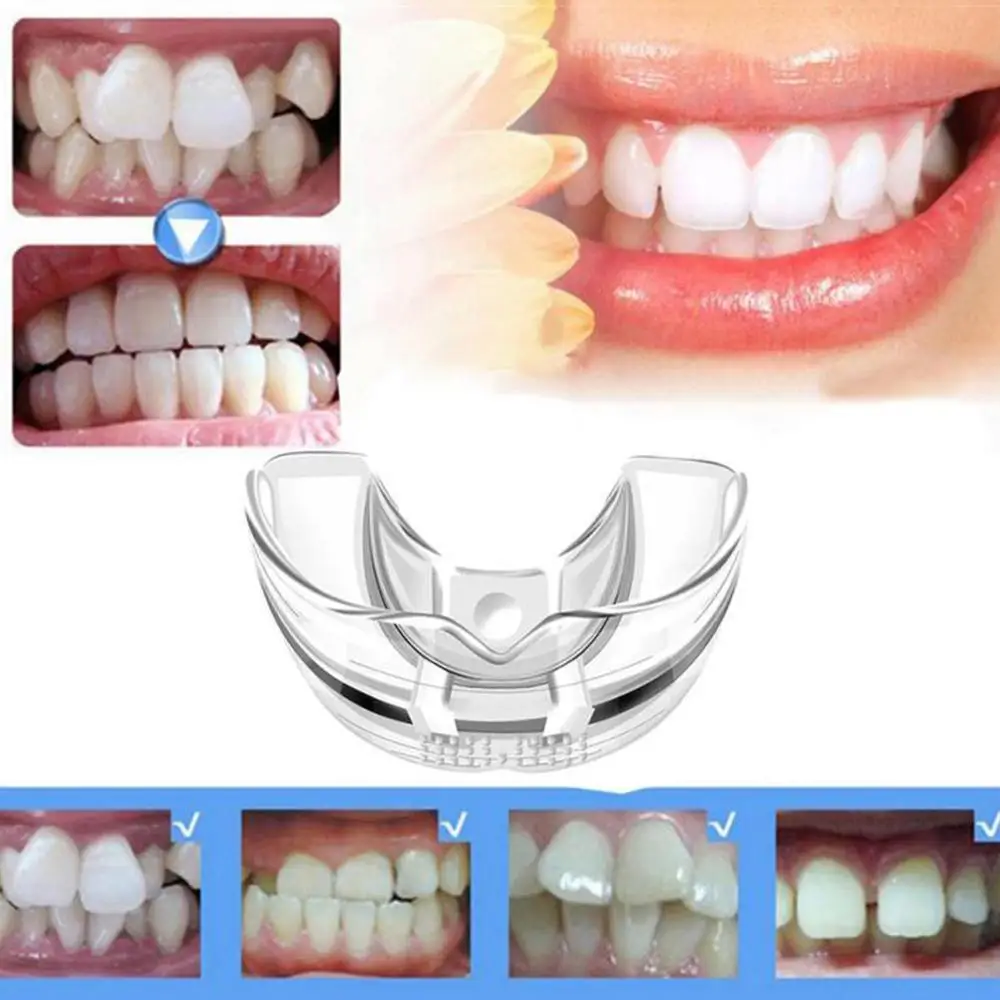 4D ортодонтический локатор Защита зубов Ортодонтические брекеты невидимые