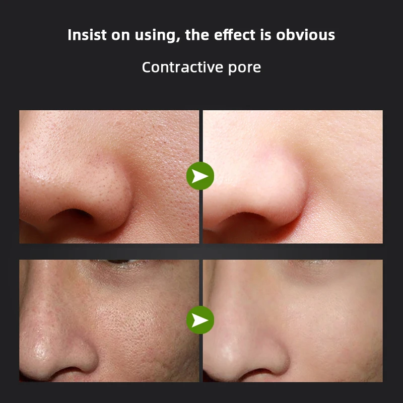 Бамбуковая угольная маска для лица удаление черных точек прыщей контроль