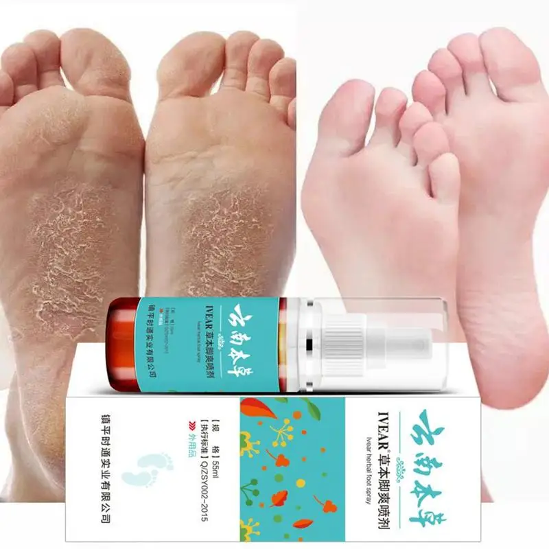 

1Pc 55ml Athlete's Foot Spray Moisturizing Antipruritic Removing Spray Deodorant Foot Athlete's E0C7