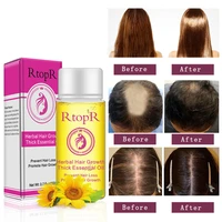 hair growth essential oil hair loss liquid promote thick fast anti hair growth treatment health care massage essence oil