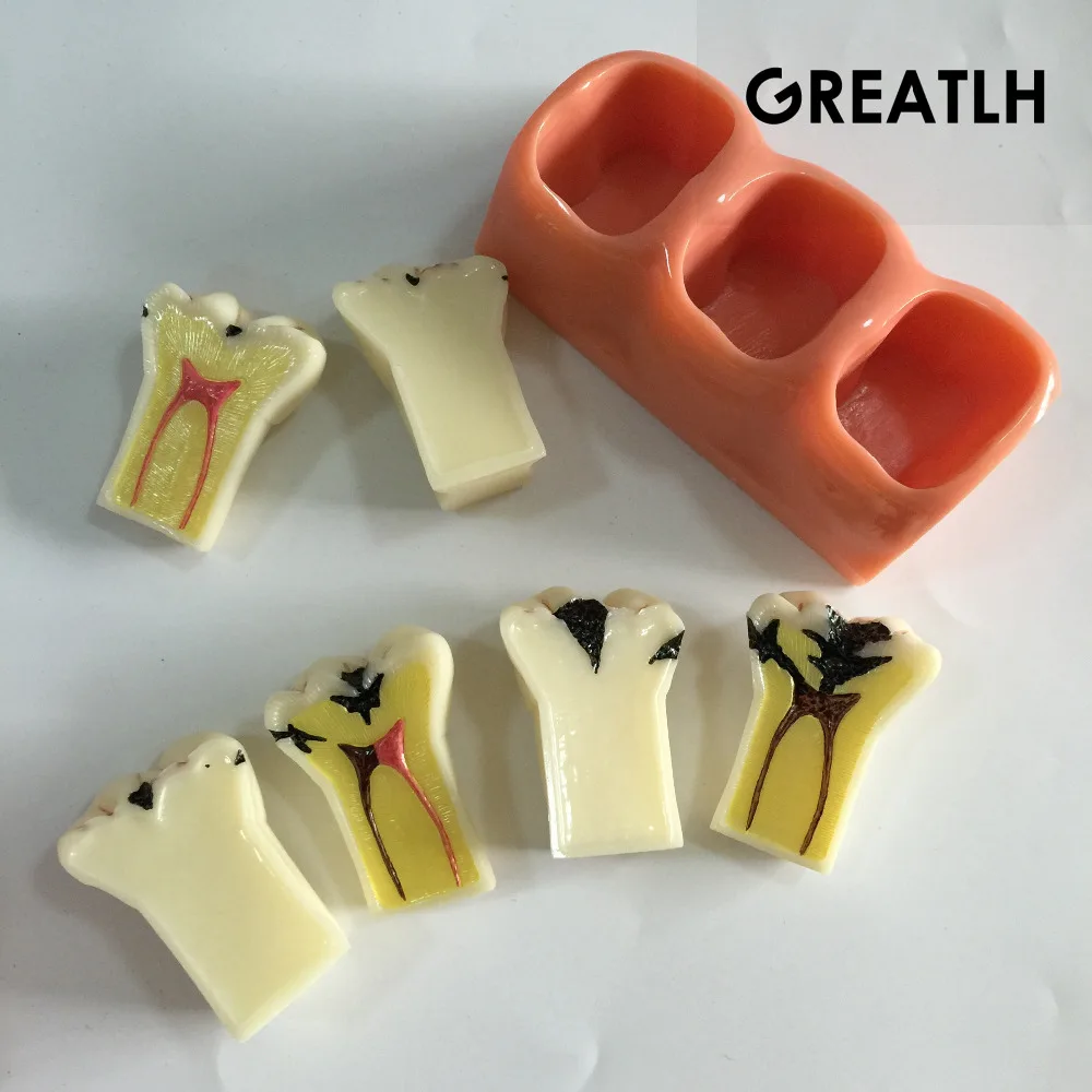 Модель зуба для зубов съемные зубы размер 4:1 обучающая модель|tooth model|removable teethdental