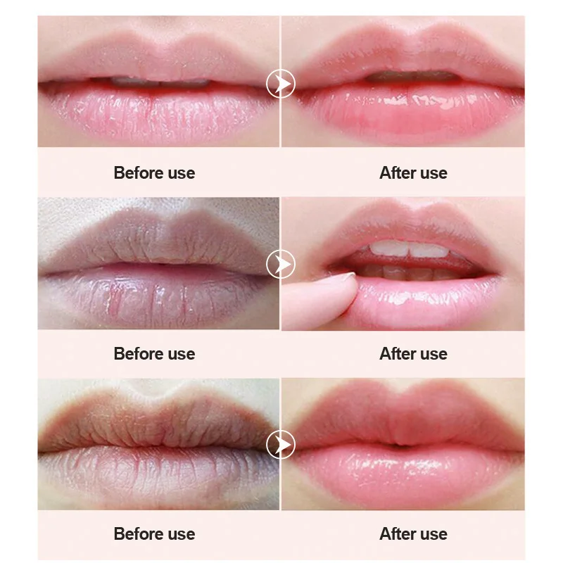 20 шт. Коллагеновые увлажняющие подкладки для губ| |