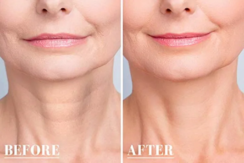 Многоразовые силиконовые накладки для груди 11 шт. на шею Набор накладок лоб