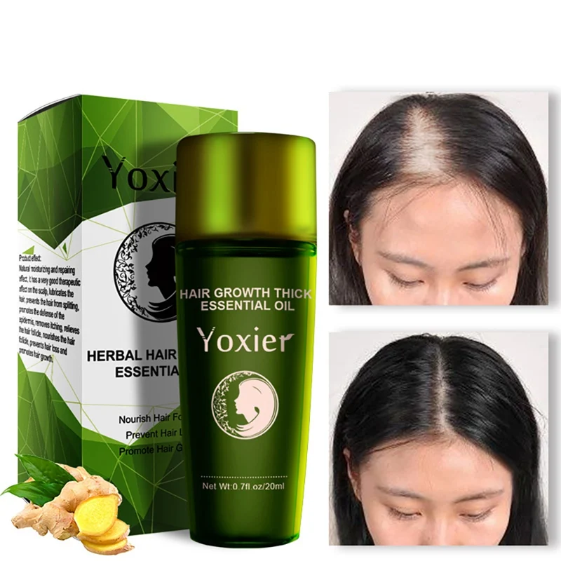 Yoxier для роста волос, анти-офф, эфирное масло, ремонт, повреждение, скорость волос, способствует росту волос, питает густые корни, восстанавливает сухие волосы