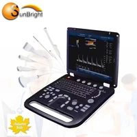 medical 4d color doppler machine ecografo portatil ultrasound scanner cw pw cardiac ultrasound