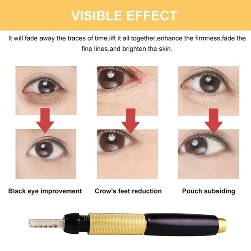 Неинвазивная ручка с гиалуроновой ручкой регулируемое неинвазивное высокое