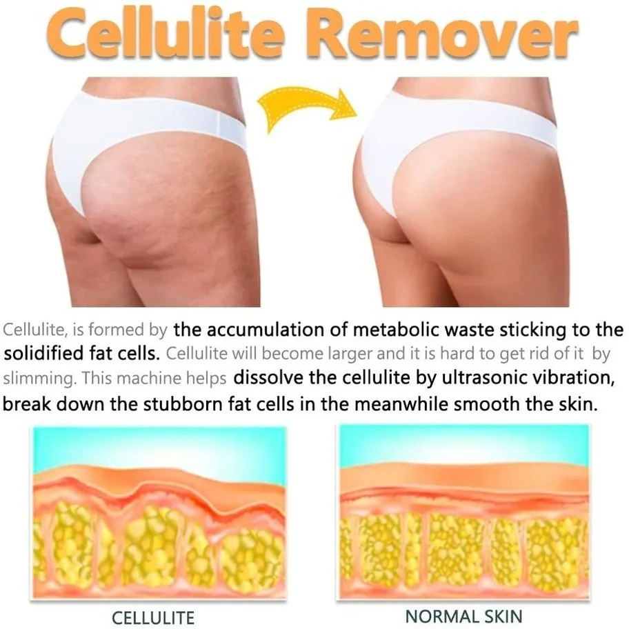 Beste Ems Ultrasone Cavitatie Lichaam Afslanken Machine Cellulitis Massager Fat Brander Machine Gewichtsverlies Massager Beauty Producten