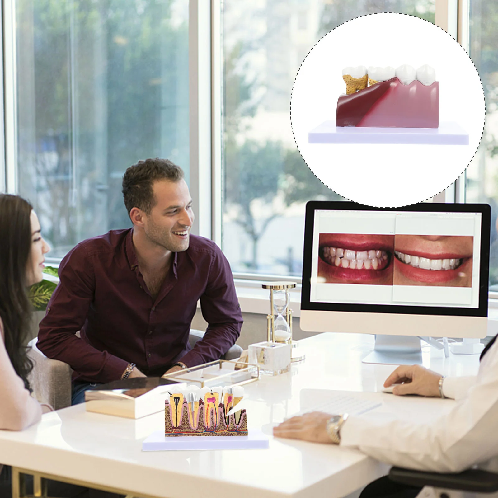 

1 Pc Caries Model Teeth Anatomical Model Decay Model Denture Teeth Model