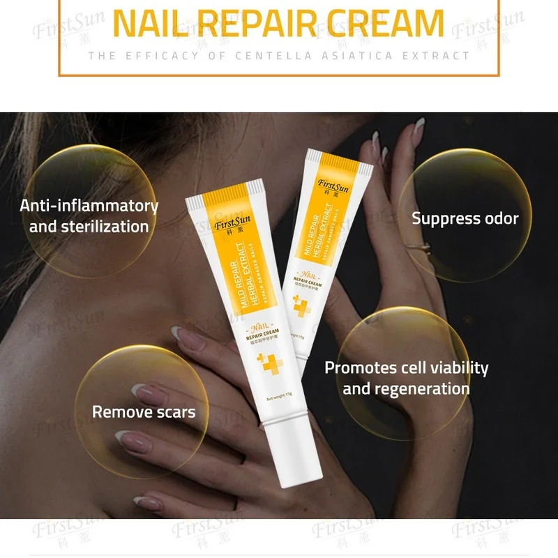 

Fungal Nail Treatment Cream Nail Repair Gel Hand Foot Nail Onychomycosis Removal Anti Fungus Nail Repair Care Hand Cream