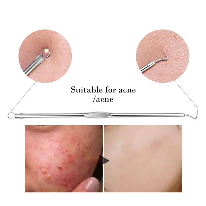 4 шт. набор для удаления чёрных точек и прыщей на лице|Устройство ухода за кожей