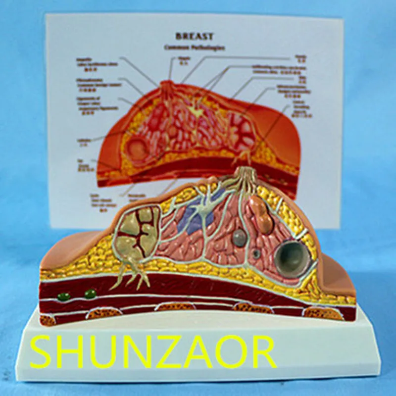 

1:1 Median Section of Human Female Breast Pathology Anatomy Model Kit Table-type breast lesion model lactating breasts