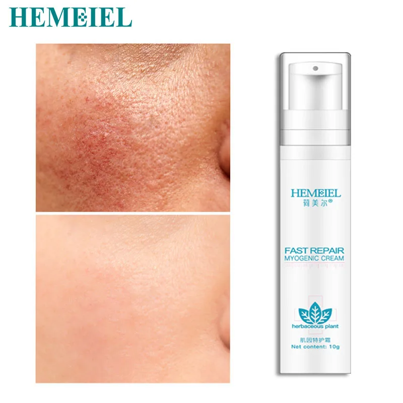 Уход за кожей лица HEMEIEL восстанавливающий крем для кожи Омолаживающий