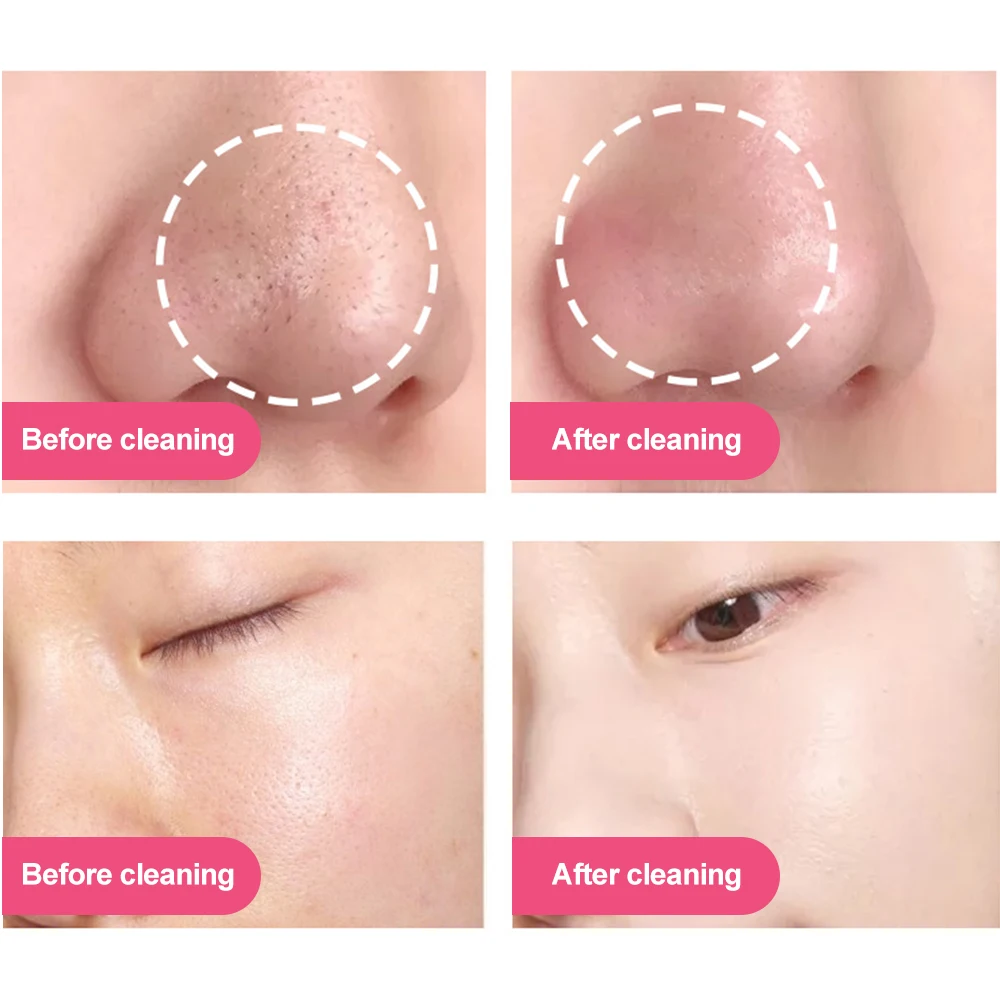 Электрическая силиконовая мини щетка для очищения лица перезаряжаемая