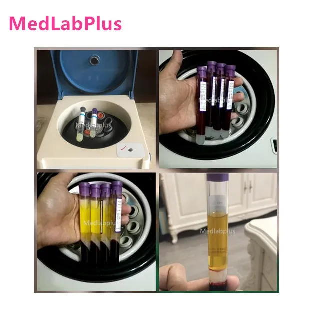 Лабораторная электрическая центрифуга PRP об/мин медицинская практика