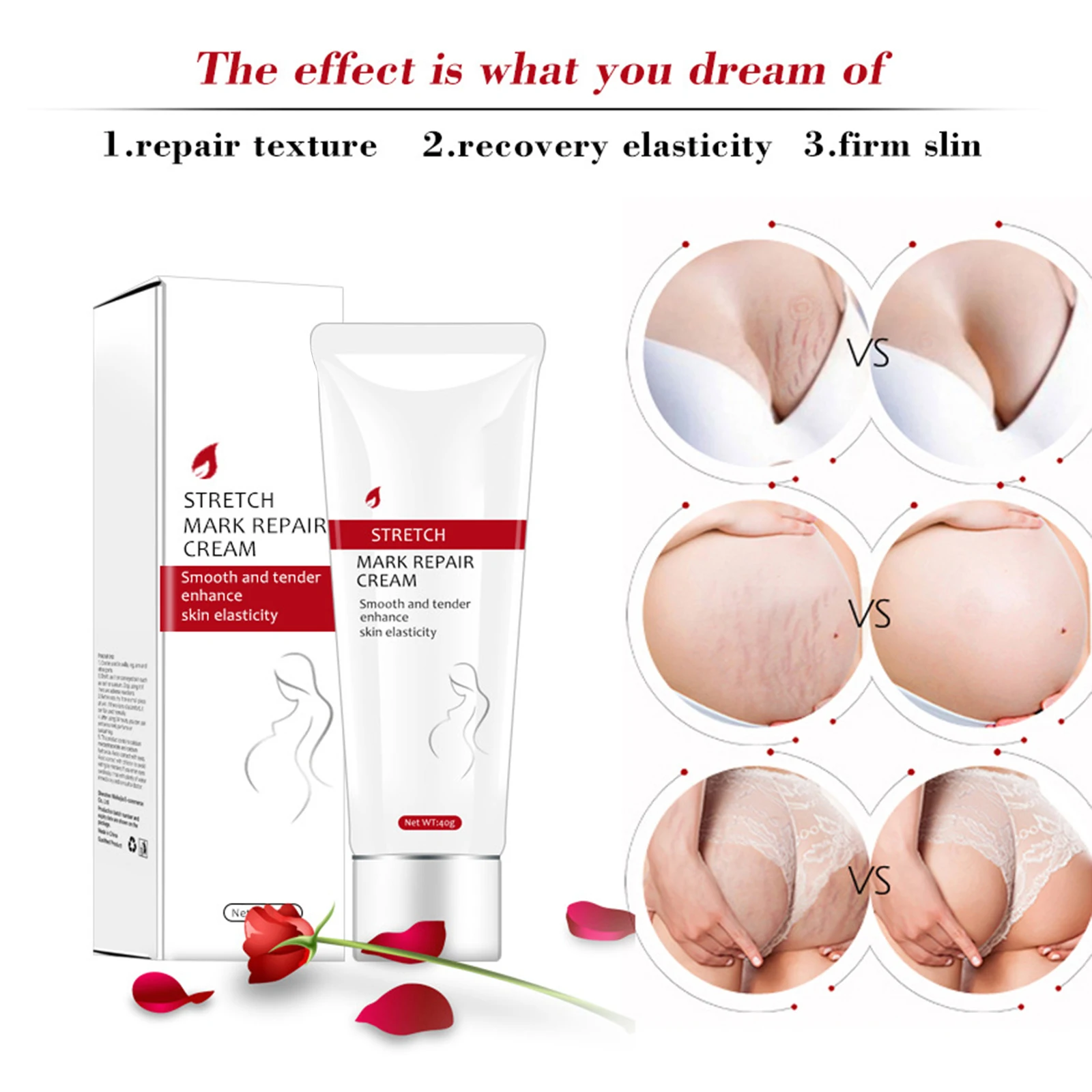 

40ml Non-irritating Stretch Mark Cream Scar Slack Line Repairing for Pregnant Woman SK88