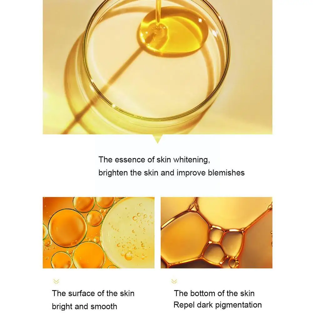 Effective Whitening Freckle Cream Remove Melasma Acne Melanin Moisturizing Pigmentation Dark Pigment Spot S V5k4 | Красота и здоровье