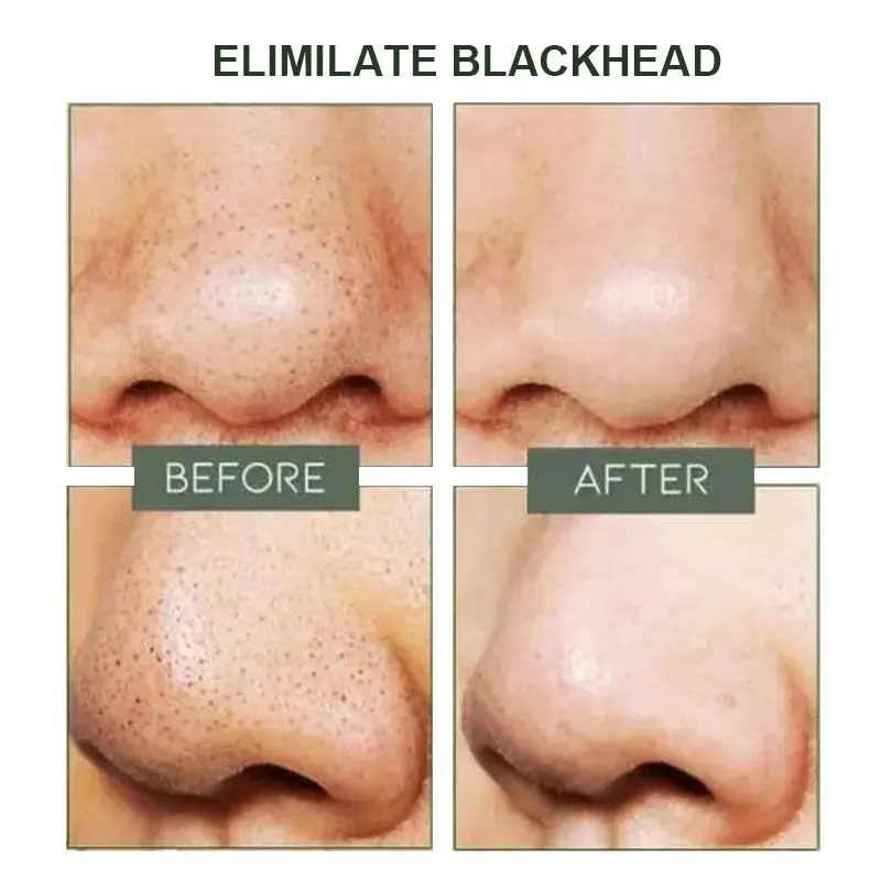 170 г грязевая маска для удаления черных точек удаление лечение акне глубокая