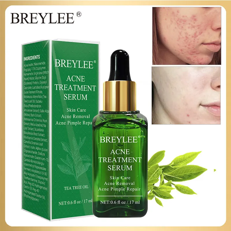 Эсенция BREYLEE для удаления акне 17 мл сыворотка ухода за кожей лица лечение прыщей
