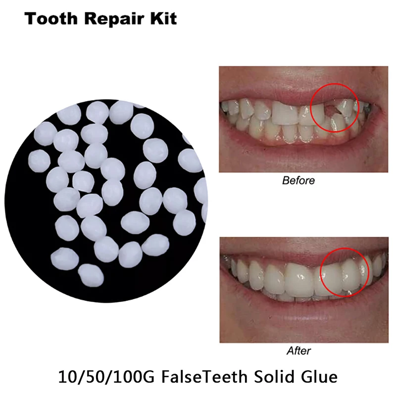 

5g/10/50g/100g False Teeth Solid Glue Temporary Tooth Repair Set Teeth and Gap Falseteeth Solid Glue Denture Adhesive Teeth Care