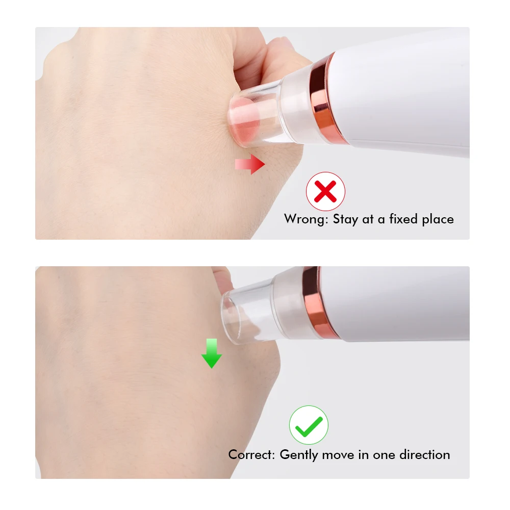 

Vacuum Pore Cleaner Face Cleaning Blackhead Acne Removal Suction Black Spot Cleaner Facial Cleansing Cosmetology Face Machine