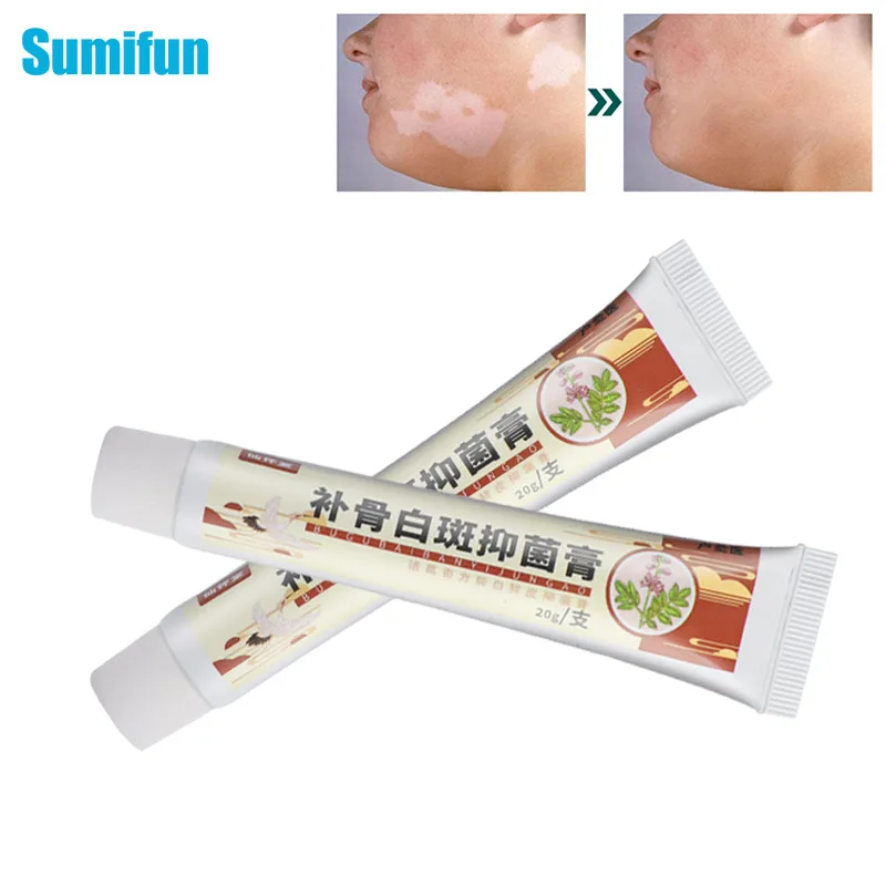 

20g White Spot Cream Vitiligo Treatment Antibacterial Cream Pigment Melanin Promoting Cream Chinese Herbal Plaster Skin Care