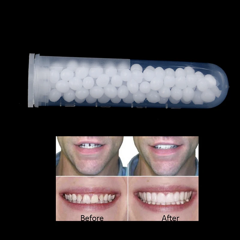 

10g Solid Glue Unisex Temporary Tooth Repair Kit Teeth And Gaps False Teeth Solid Glue Denture Adhesive Teeth Whitening Tooth