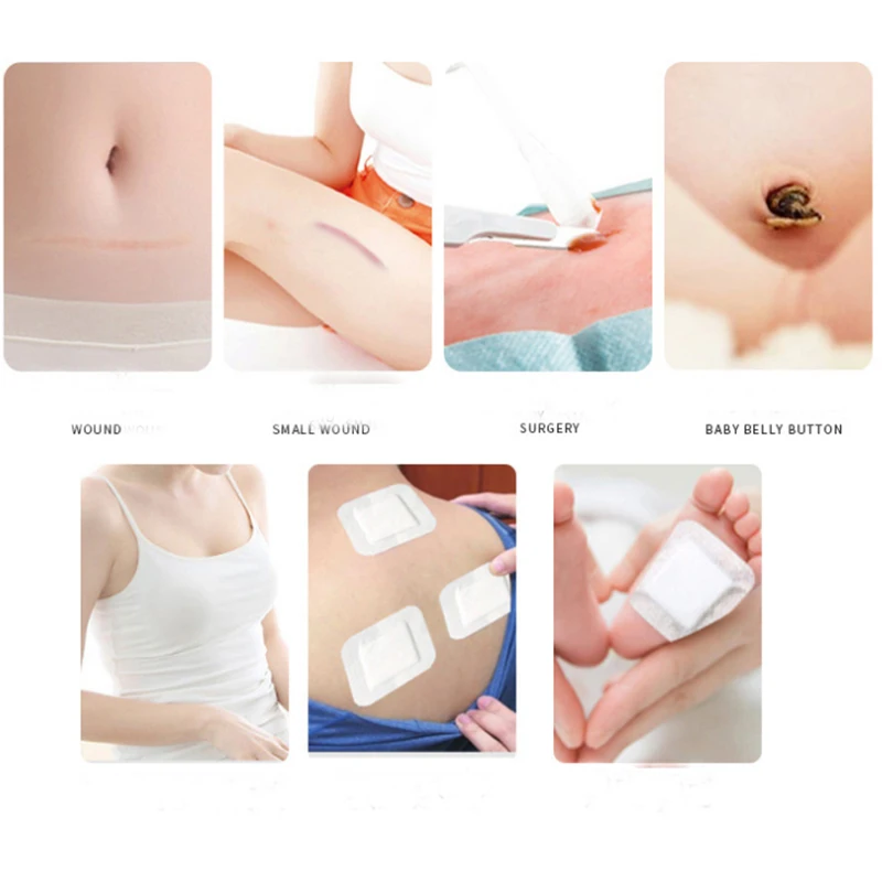 NEW PRODUCT chitin chitosan wound healing dressing aseptic care patch 8x12cm | Красота и здоровье