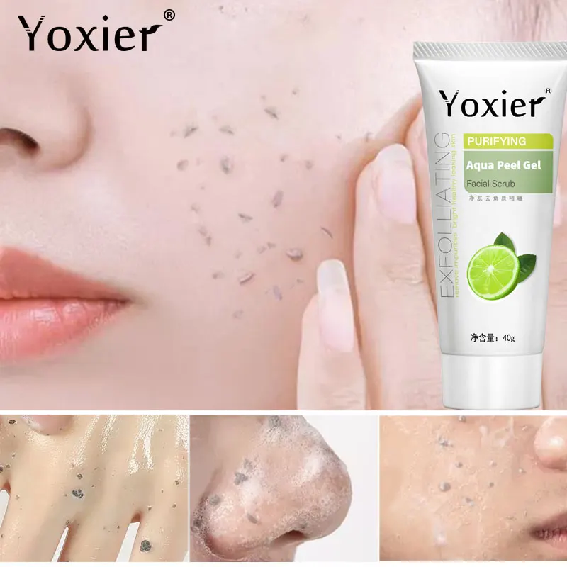 

Yoxier Exfoliating Face Scrub Peeling Gel Moisturizing Whitening Lemon Vitamin C Remove Acne Detoxifies And Cleanses All Skin