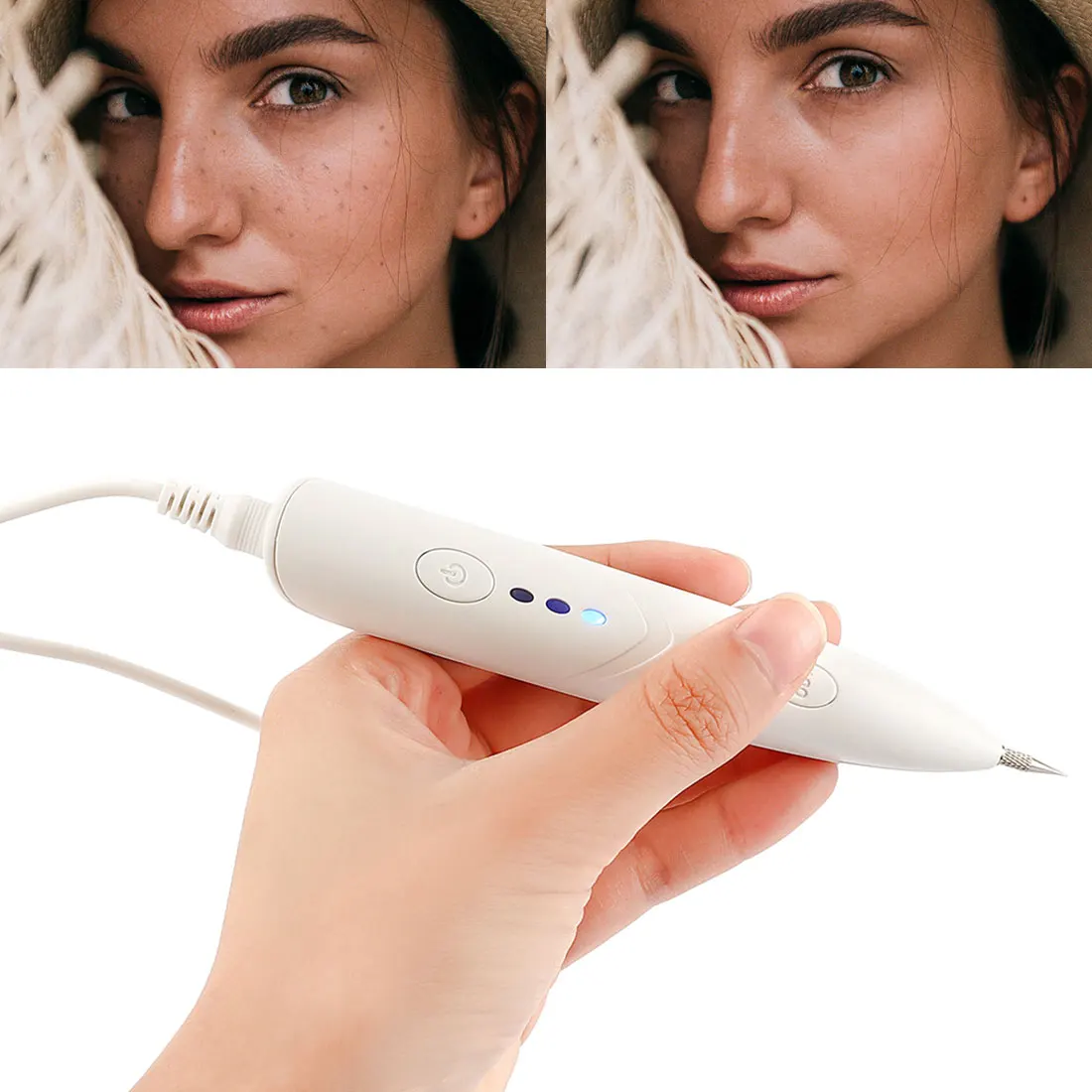 Новинка плазменное устройство для удаления татуировок родинок этикетка кожи