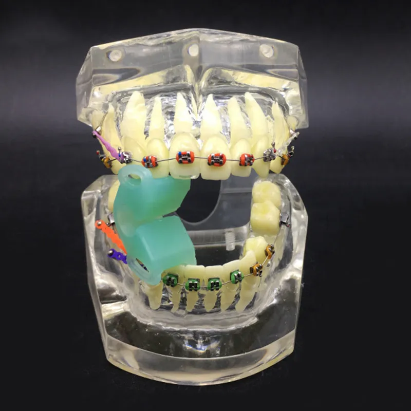 Стоматологическая стандартная Ортодонтическая модель прозрачная коррекция