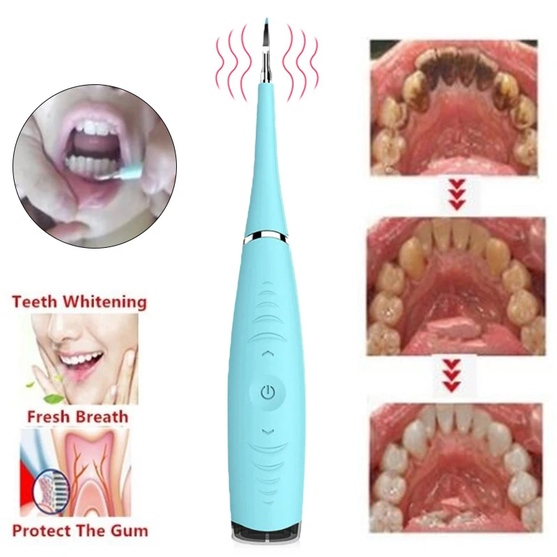 

USB Recharge Vibration Sonic Dental Scaler Tooth Calculus Remover Tooth Stains Tartar Cleaner Tool Whiten Teeth Dropshipping