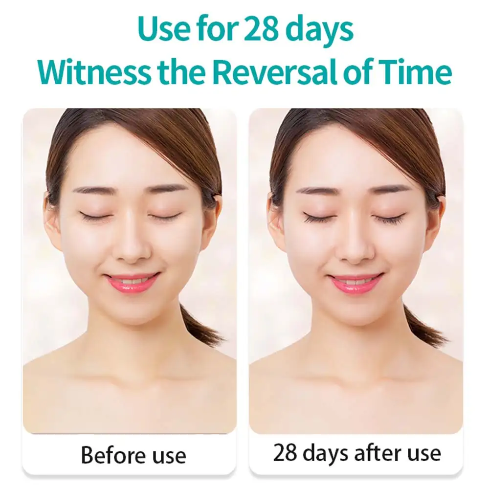 

EMS Electric Vibration Eye Face Massager Anti-Ageing Wrinkle Dark Circle Pen Removal Rejuvenation Beauty Care Portable Pen