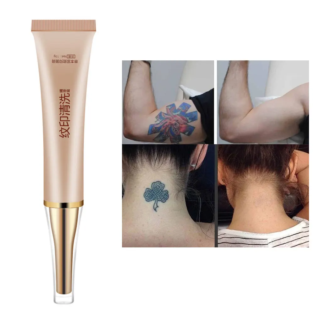 Безопасный и не раздражающий Перманентный крем для удаления татуировок