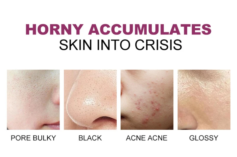 Гель-скраб для глубокого отшелушивания кожи лица отшелушивающий ремонт