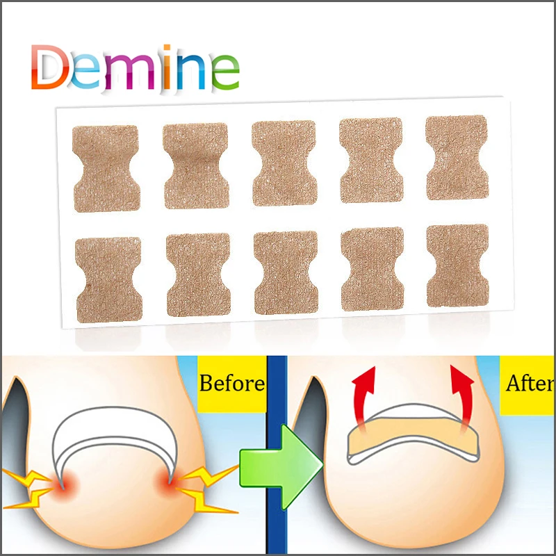 

New Ingrown Toenail Bandage To Relieve Pain And Paronychia Treatment Nail Repair Bandage Toe Nail Care