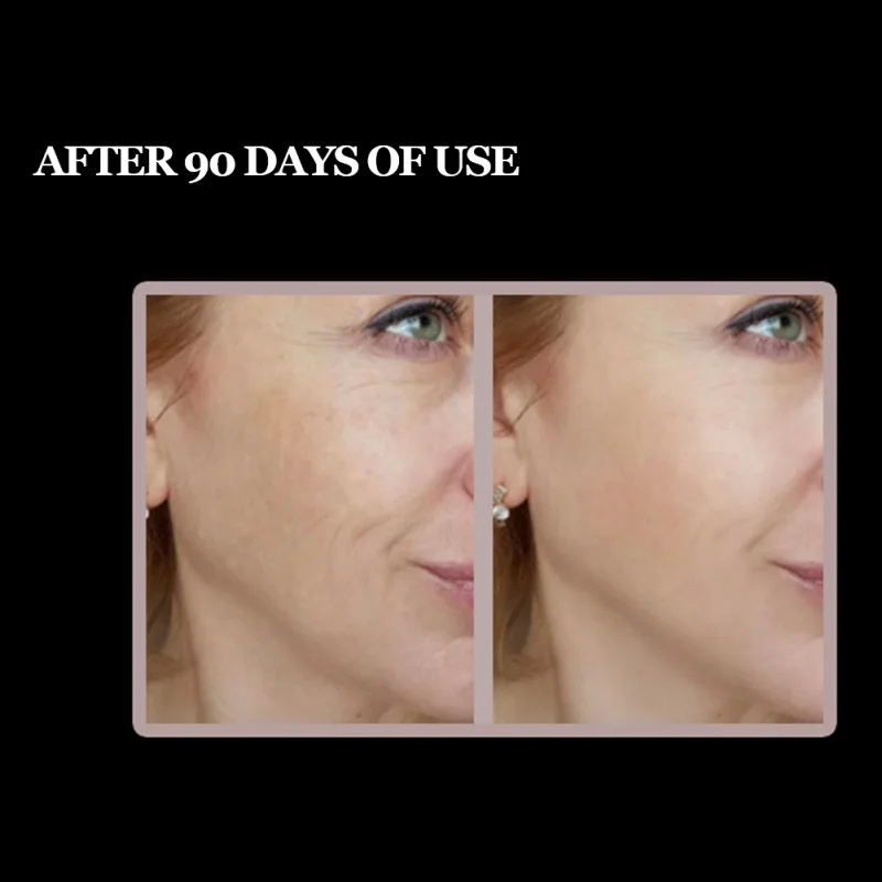 Ультразвуковой микро перегрузок по току вибрации Уход за кожей лица-средство для