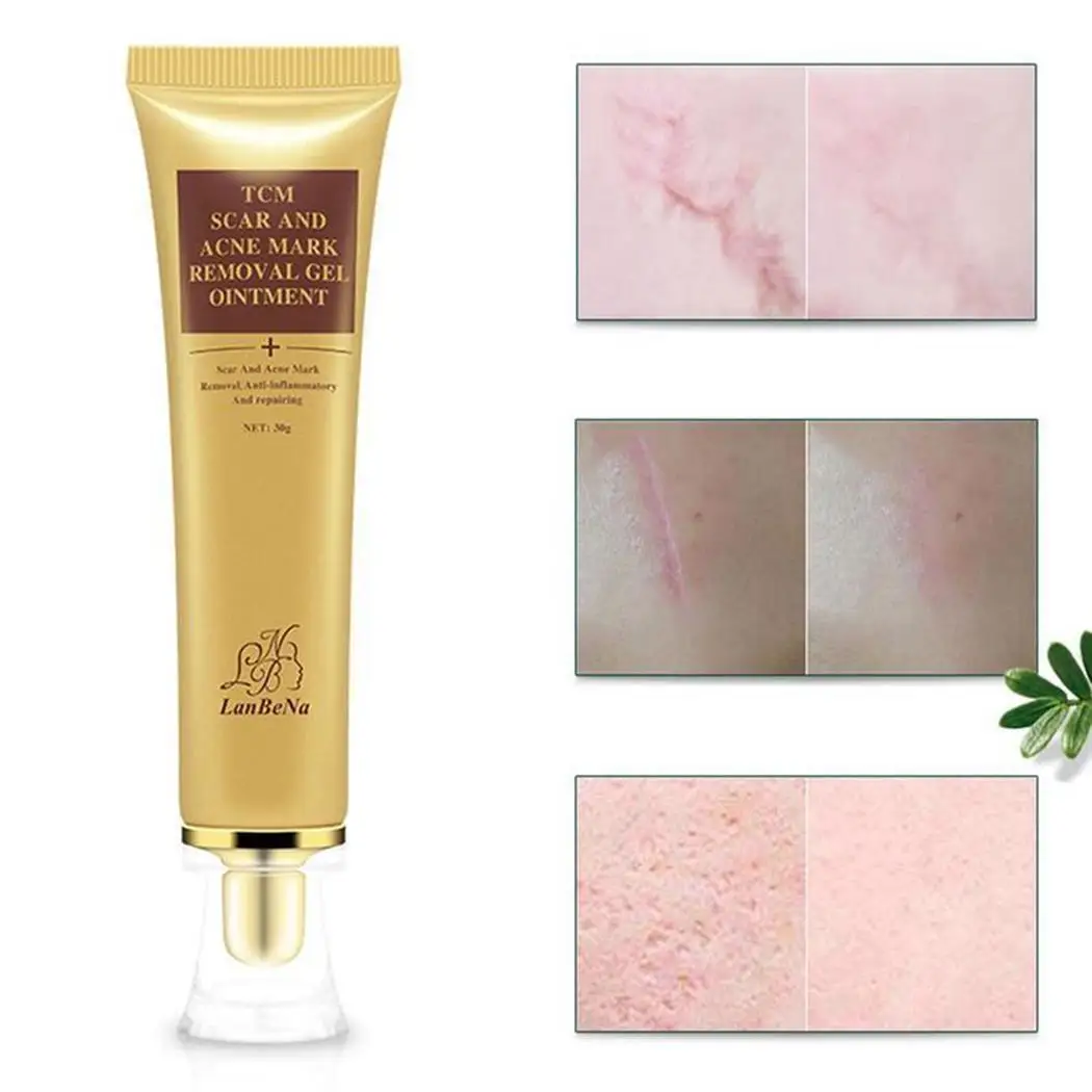 Натуральная трава увлажняющий шрам для удаление геля постугревых рубцов 30 г всех